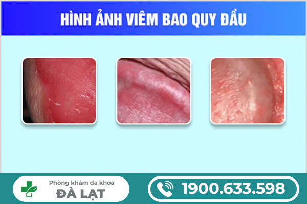 Hình ảnh minh họa